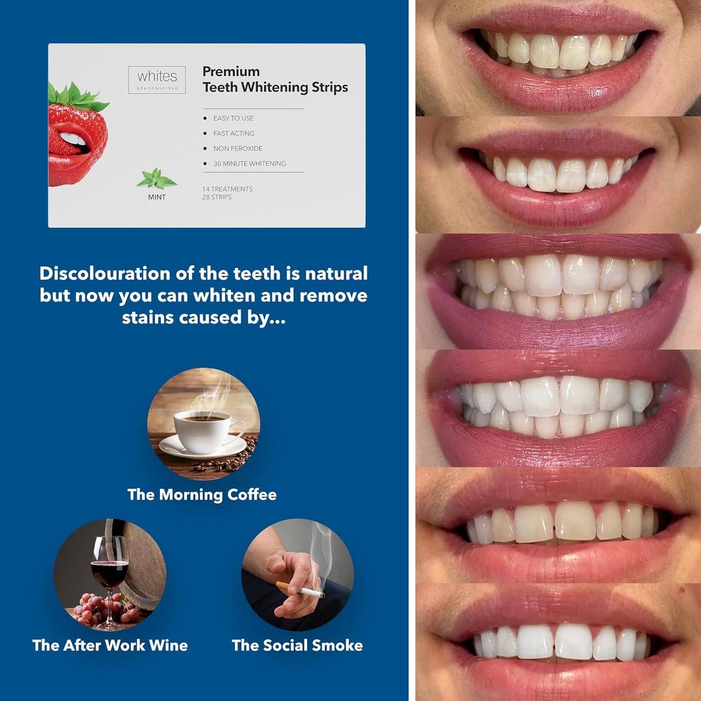 Whites Beaconsfield Teeth Whitening Strips