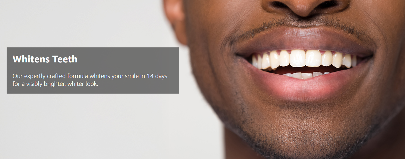 Whites Beaconsfield Teeth Whitening Strips